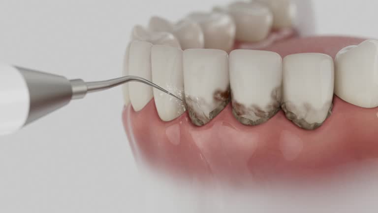 Reliable Dental contractor in Lexington, OH by Dentist Open Now
